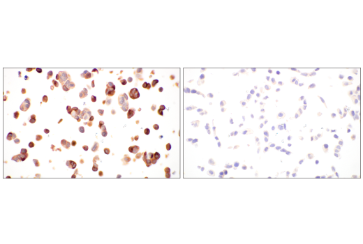 Immunohistochemistry Image 12: LCN2 (D4M8L) Rabbit Monoclonal Antibody