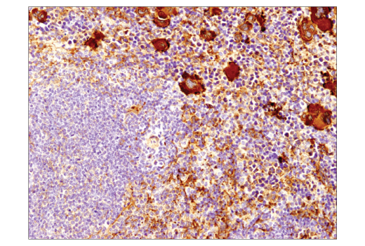 Immunohistochemistry Image 3: Vinculin (E1E9V) XP<sup>®</sup> Rabbit mAb (BSA and Azide Free)