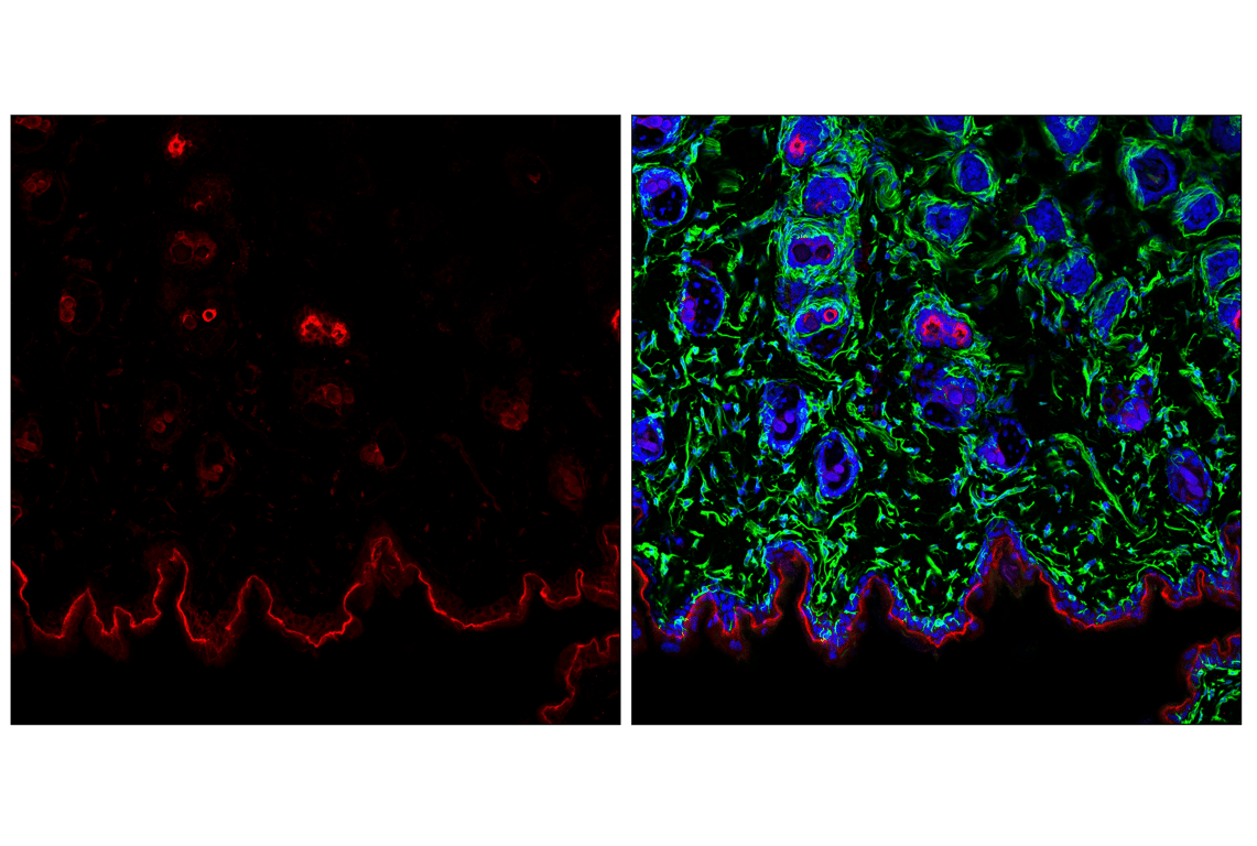 Immunofluorescence Image 2: Pan-Keratin (C11) Mouse mAb (Alexa Fluor<sup>®</sup> 555 Conjugate)