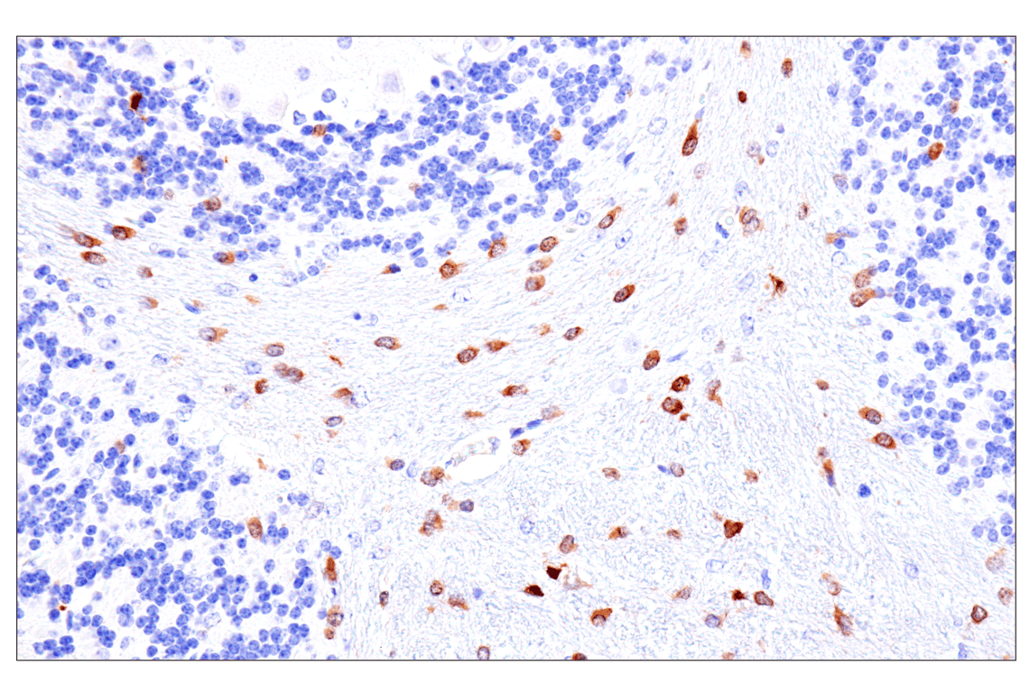 Immunohistochemistry Image 1: Olig1 (E3T6D) Rabbit Monoclonal Antibody