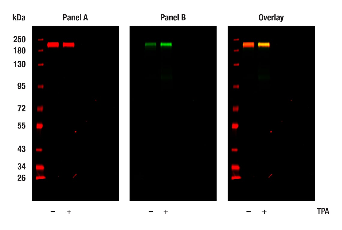Western Blotting Image 1: HER2/ErbB2 (44E7) Mouse Monoclonal Antibody