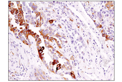 Immunohistochemistry Image 2: DCLK1/DCAMKL1 (D2U3L) Rabbit Monoclonal Antibody (BSA and Azide Free)