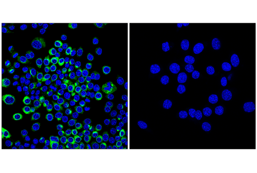 Immunofluorescence Image 1: Osteopontin/SPP1 (E4O2F) Rabbit Monoclonal Antibody