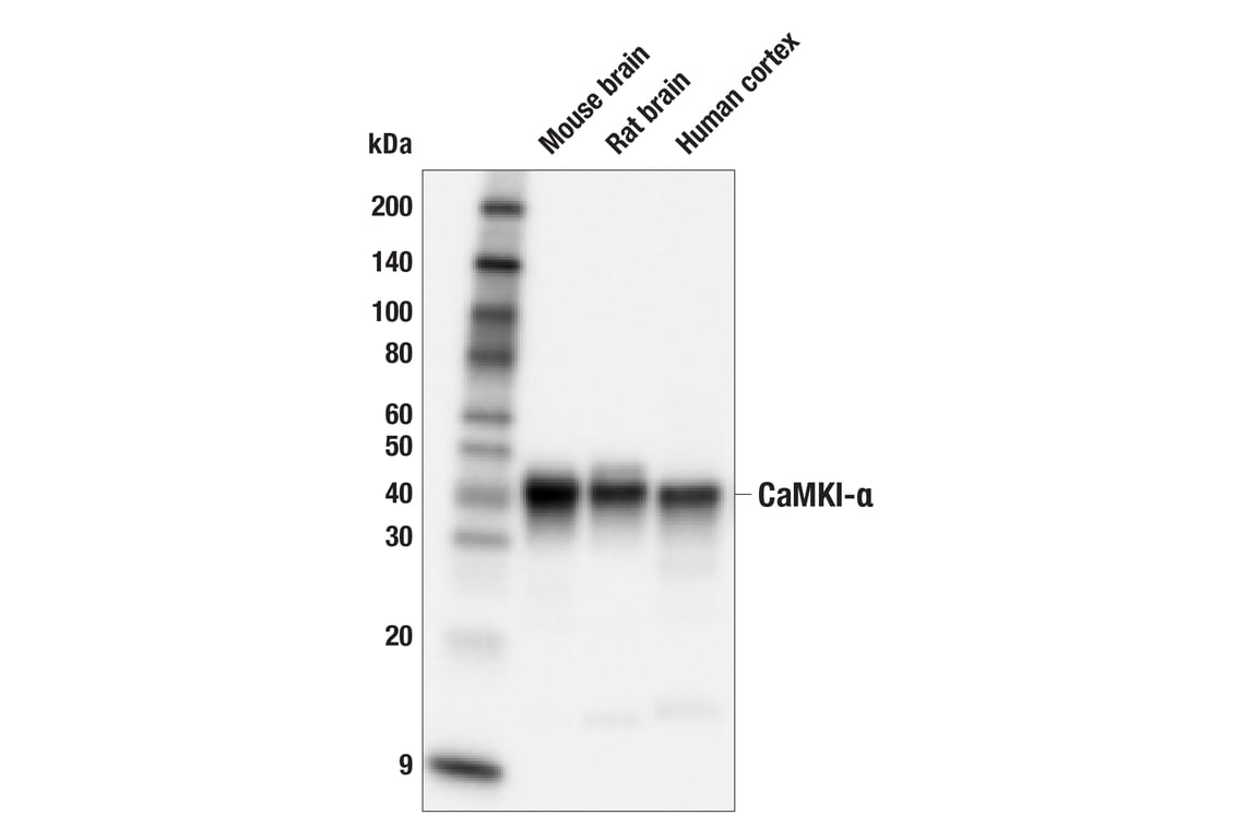 Western Blotting Image 2: CaMKI-alpha (F1M8F) Rabbit Monoclonal Antibody