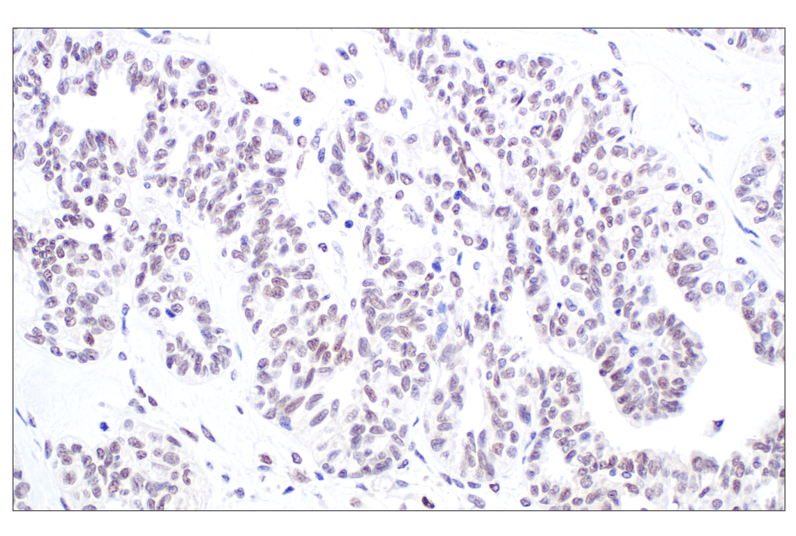 Immunohistochemistry Image 4: TFE3 (F3Z2Q) Rabbit Monoclonal Antibody
