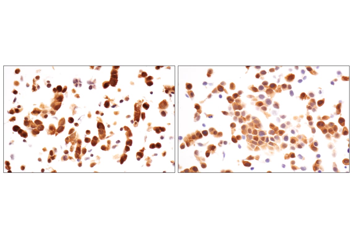Immunohistochemistry Image 13: ACBP/DBI (E6K8G) Rabbit Monoclonal Antibody