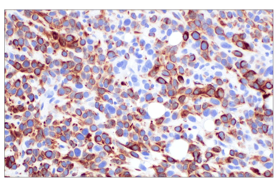 Immunohistochemistry Image 6: Keratin 14 (E7W6V) Rabbit Monoclonal Antibody