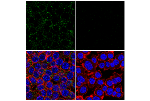 Immunofluorescence Image 2: Paxillin (E6R6Z) Rabbit Monoclonal Antibody (BSA and Azide Free)