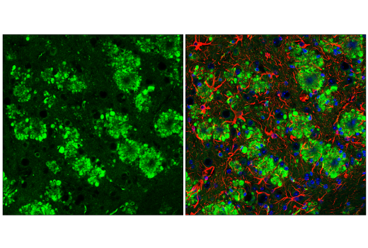 Immunofluorescence Image 3: Rab7 (E9O7E) Mouse Monoclonal Antibody