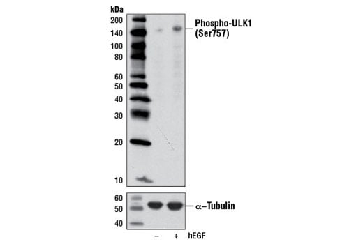 undefined Image 12: ULK1 Antibody Sampler Kit