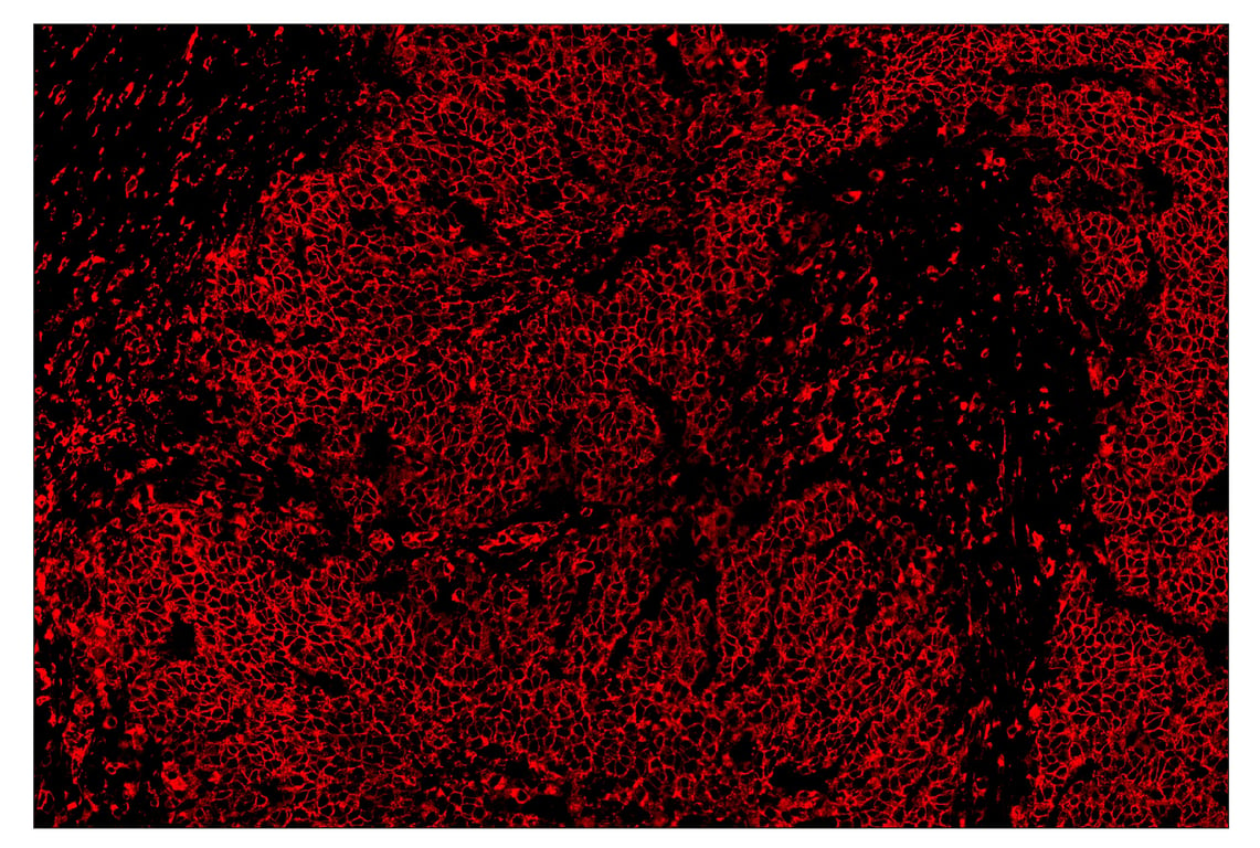 Immunohistochemistry Image 4: HLA-DRA (E9R2Q) & CO-0023-647 SignalStar<sup>™</sup> Oligo-Antibody Pair