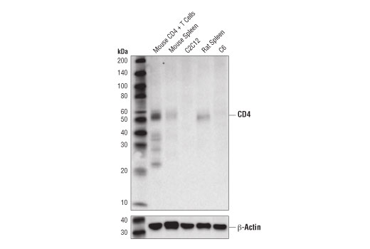 Western Blotting Image 1: CD4 (D7D2Z) Rabbit mAb