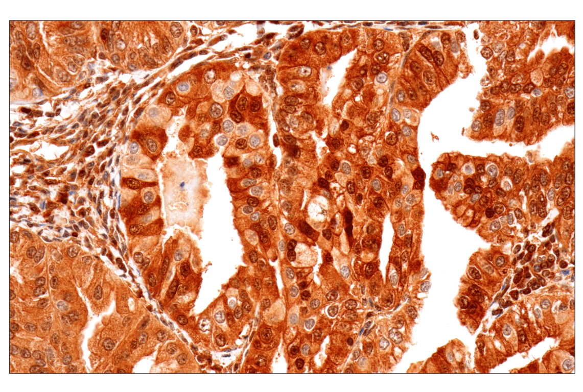 Immunohistochemistry Image 2: MTAP (E5R1I) Rabbit Monoclonal Antibody