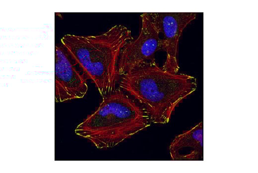 Immunofluorescence Image 1: alpha-Parvin Antibody