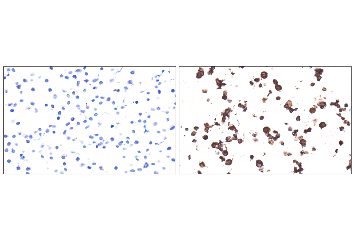 Immunohistochemistry Image 17: Syndecan 1 (E7F7T) Rabbit Monoclonal Antibody