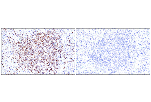 Immunohistochemistry Image 8: RUNX3/AML2 (E8D5W) Rabbit Monoclonal Antibody