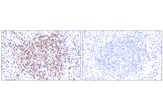 Immunohistochemistry Image 8: RUNX3/AML2 (E8D5W) XP<sup>®</sup> Rabbit mAb