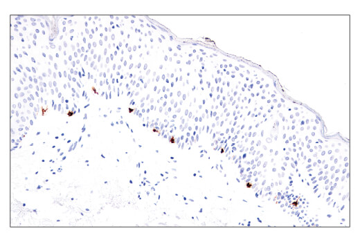 Immunohistochemistry Image 3: MLANA/MART-1 (E9Q4O) Rabbit Monoclonal Antibody