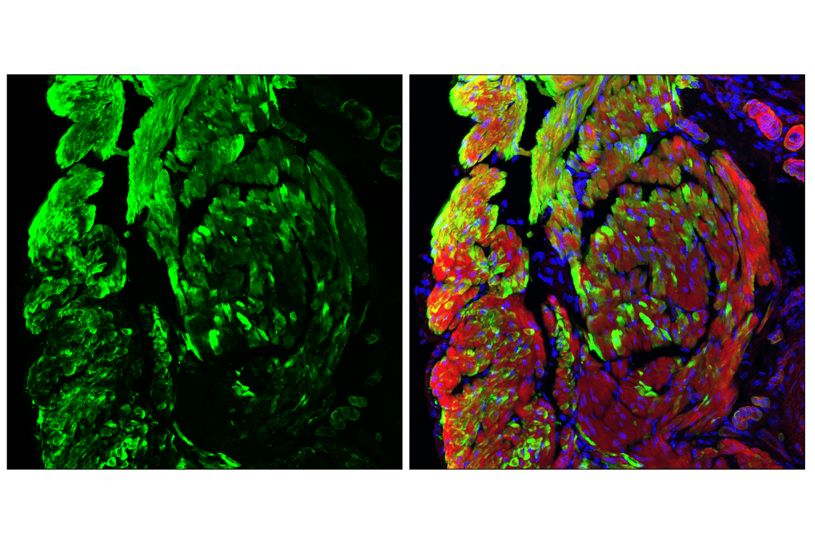 Immunofluorescence Image 1: MYH11 (E4Q4L) Rabbit Monoclonal Antibody