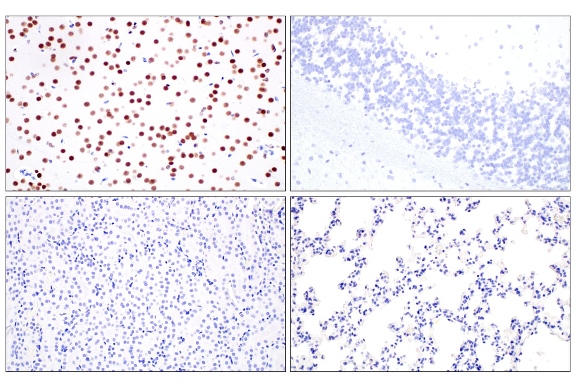 Immunohistochemistry Image 5: FOXG1 (E2W8P) Rabbit Monoclonal Antibody