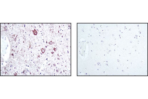 undefined Image 19: Alzheimer's Disease Antibody Sampler Kit