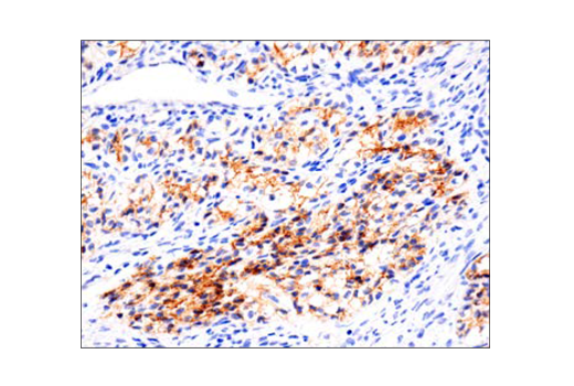 Immunohistochemistry Image 2: N-Cadherin (D4R1H) Rabbit Monoclonal Antibody