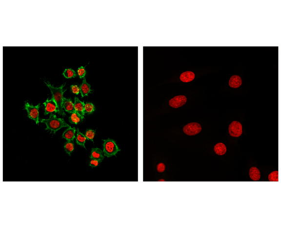 Immunofluorescence Image 1: CD45 (D3F8Q) Rabbit Monoclonal Antibody (BSA and Azide Free)