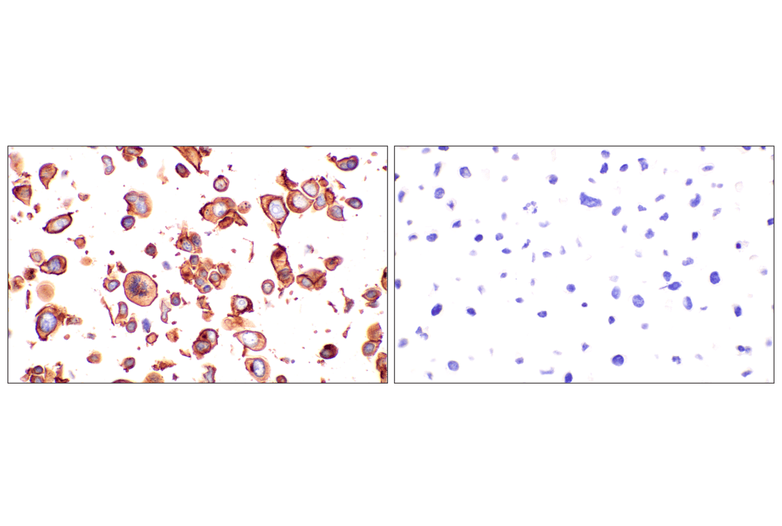 Immunohistochemistry Image 10: CD10/Neprilysin (F4P6H) Rabbit Monoclonal Antibody