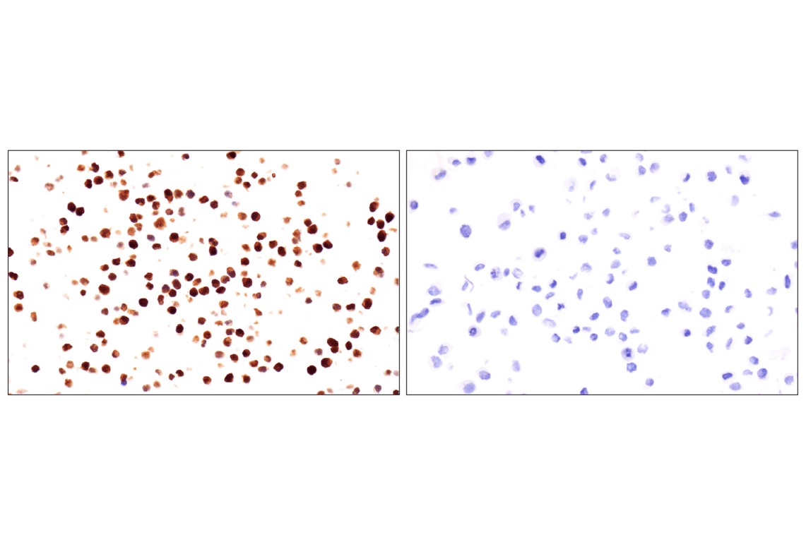 Immunohistochemistry Image 11: p47phox (F3Y6C) Rabbit Monoclonal Antibody