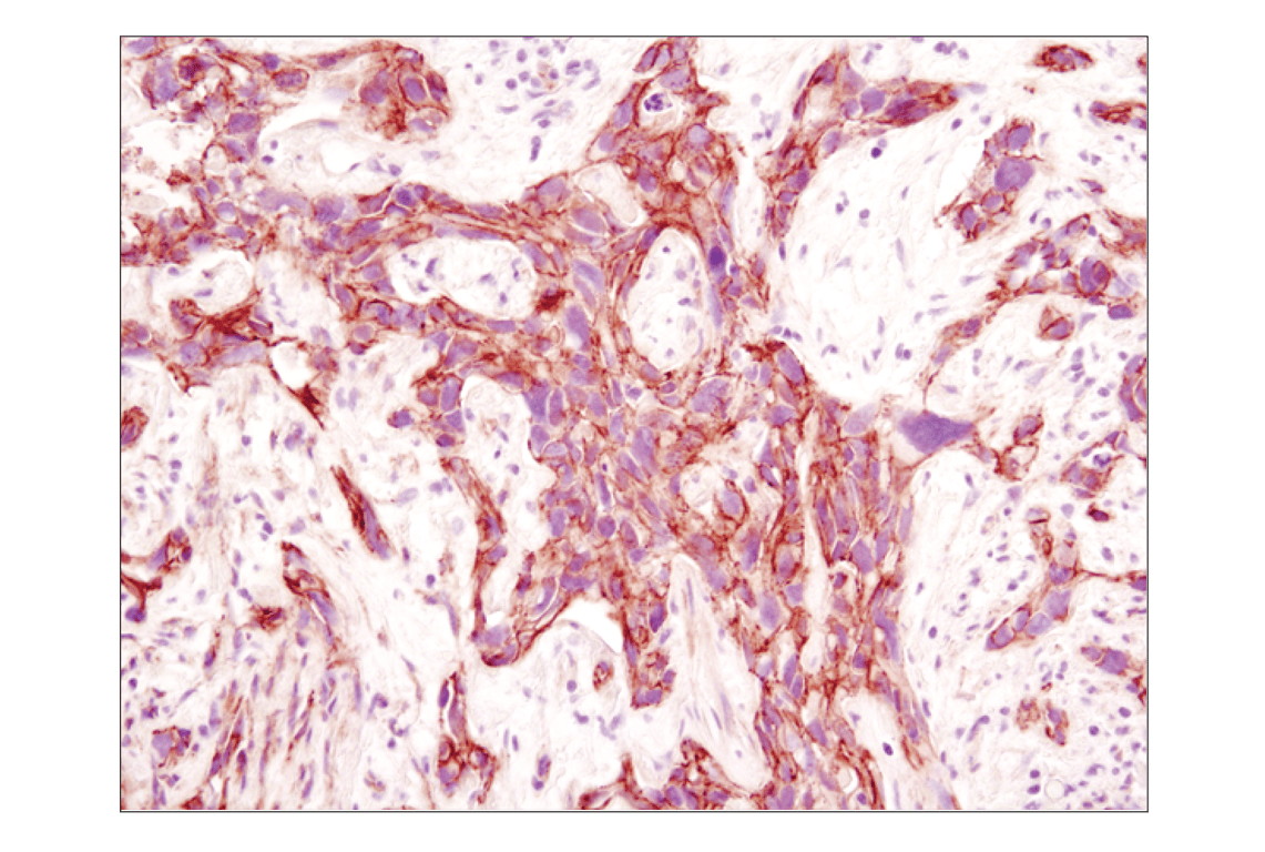 Immunohistochemistry Image 5: beta-Catenin (D10A8) Rabbit Monoclonal Antibody