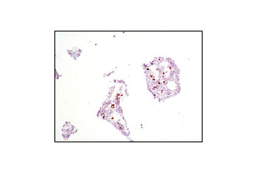 Immunohistochemistry Image 2: GATA-1 (D52H6) Rabbit Monoclonal Antibody (BSA and Azide Free)