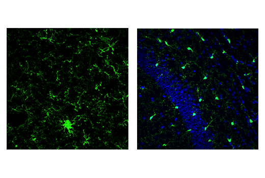 Immunofluorescence Image 1: Iba1/AIF-1 (E4O4W) Rabbit Monoclonal Antibody (BSA and Azide Free)