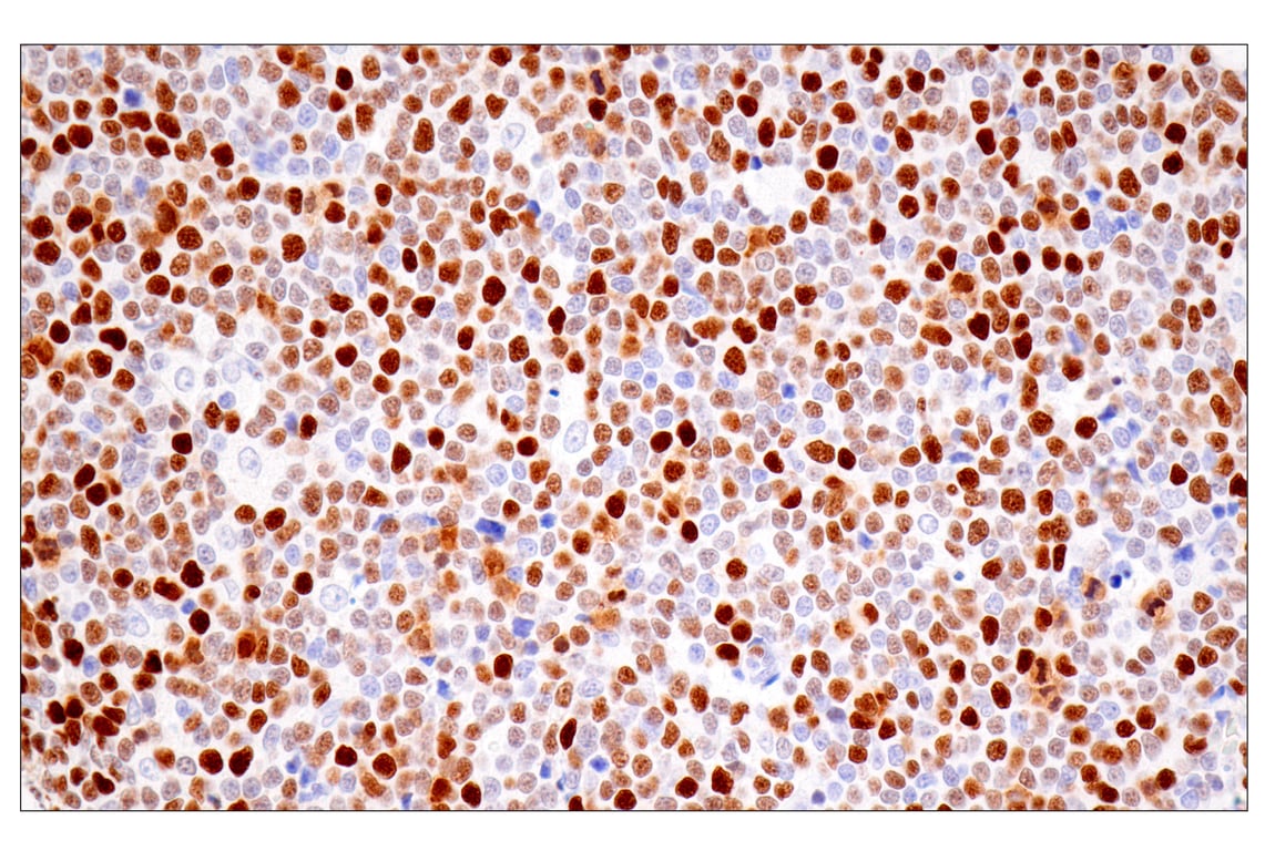 Immunohistochemistry Image 6: UHRF1 (E5W8W) Rabbit Monoclonal Antibody