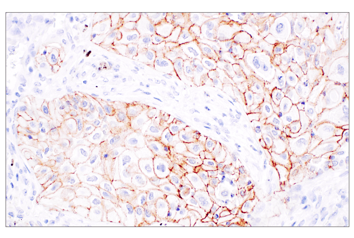Immunohistochemistry Image 2: P-Cadherin (C13F9) Rabbit Monoclonal Antibody