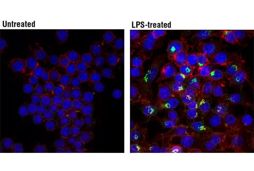 Immunofluorescence Image 1: IL-6 (D5W4V) Rabbit Monoclonal Antibody (BSA and Azide Free)