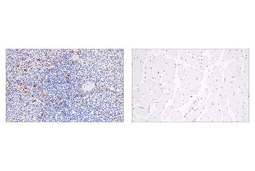 undefined Image 26: Gasdermin Family Antibody Sampler Kit