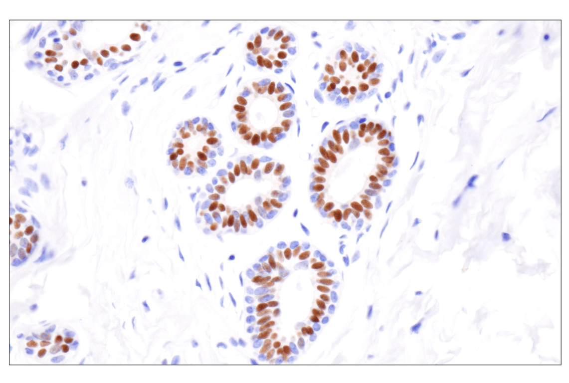 Immunohistochemistry Image 3: Estrogen Receptor alpha (D8H8) Rabbit Monoclonal Antibody