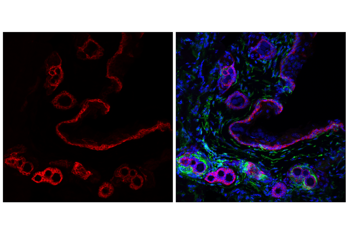 Immunofluorescence Image 1: Keratin 5 (E2T4B) Rabbit Monoclonal Antibody (Alexa Fluor<sup>®</sup> 647 Conjugate)