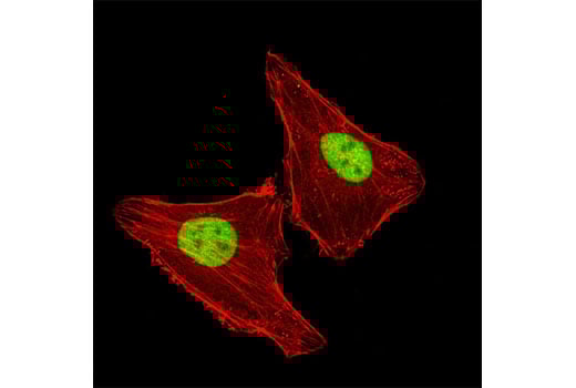 Immunofluorescence Image 1: LAP2 alpha (3A3) Mouse Monoclonal Antibody