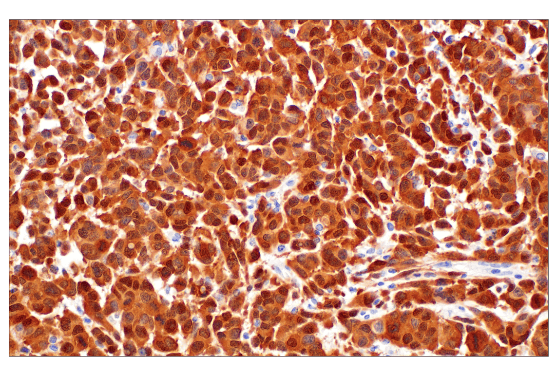 Immunohistochemistry Image 1: p16 INK4A (F2T7H) Rabbit Monoclonal Antibody