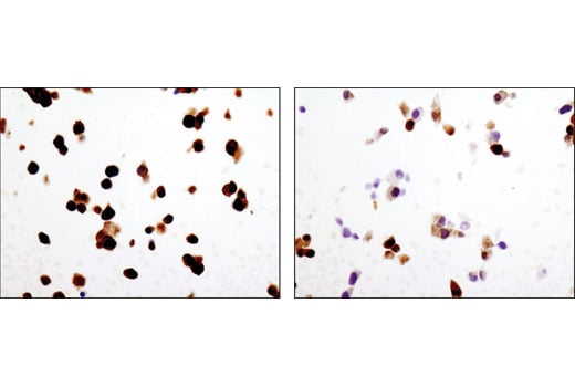 Immunohistochemistry Image 3: Phospho-Tyrosine Hydroxylase (Ser31) (D6I9V) Rabbit Monoclonal Antibody