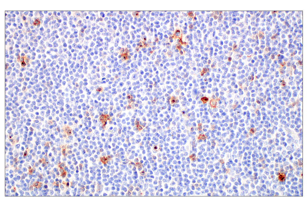 Immunohistochemistry Image 5: CD70 (E3Q1A) Rabbit Monoclonal Antibody