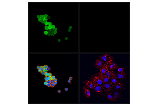 Immunofluorescence Image 1: Calretinin (E7R6O) Rabbit Monoclonal Antibody