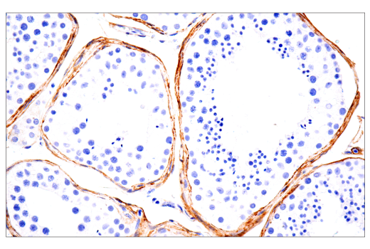 Immunohistochemistry Image 7: TMEM119 (E3E4T) Mouse Monoclonal Antibody (BSA and Azide Free)