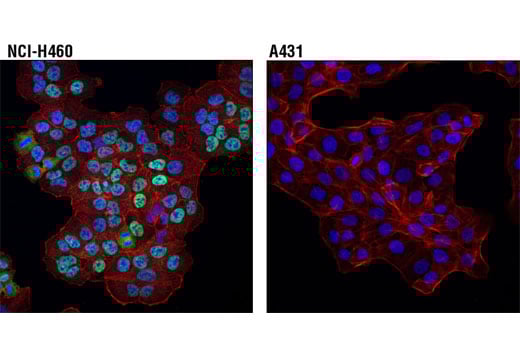 Immunofluorescence Image 1: DAX1 (D2F1) Rabbit Monoclonal Antibody