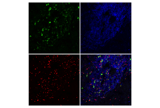 IL-2Rα/CD25 (E9W2J) XP® Rabbit mAb (BSA and Azide Free