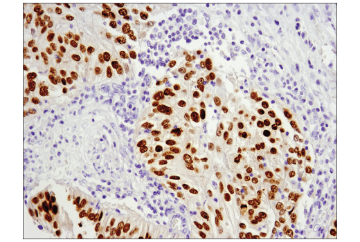 Immunohistochemistry Image 3: Pax6 (D3A9V) Rabbit Monoclonal Antibody (BSA and Azide Free)