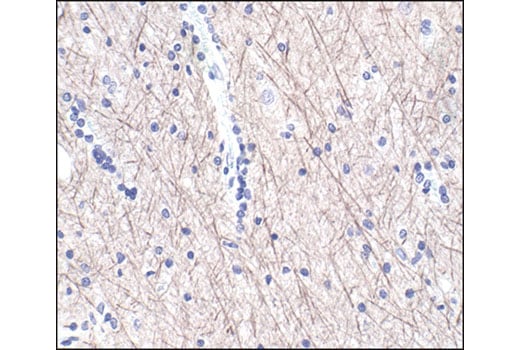 Immunohistochemistry Image 1: Neurofilament-L (DA2) Mouse Monoclonal Antibody
