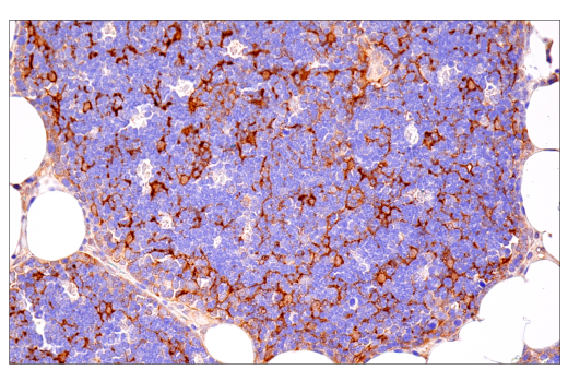 Immunohistochemistry Image 10: NF-kappaB1 p105/p50 (D7H5M) Rabbit Monoclonal Antibody (BSA and Azide Free)