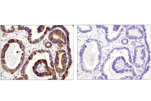 Immunohistochemistry Image 3: PLD2 (E1Y9L) Rabbit Monoclonal Antibody